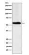 Alpha-ketoglutarate-dependent dioxygenase FTO antibody, M00219, Boster Biological Technology, Western Blot image 