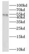 Ring Finger Protein 25 antibody, FNab07353, FineTest, Western Blot image 