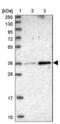 Multivesicular Body Subunit 12B antibody, NBP2-13979, Novus Biologicals, Western Blot image 