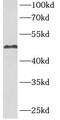 Carbonic Anhydrase 9 antibody, FNab01167, FineTest, Western Blot image 