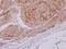 Lactate Dehydrogenase C antibody, GTX114525, GeneTex, Immunohistochemistry paraffin image 