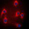 Mitogen-Activated Protein Kinase 8 Interacting Protein 3 antibody, orb215075, Biorbyt, Immunocytochemistry image 