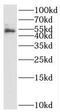 Metalloreductase STEAP4 antibody, FNab08319, FineTest, Western Blot image 