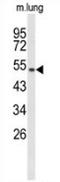MutY DNA Glycosylase antibody, AP52779PU-N, Origene, Western Blot image 