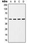 Cholinergic Receptor Nicotinic Alpha 7 Subunit antibody, orb213740, Biorbyt, Western Blot image 