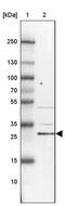 KIAA1257 antibody, PA5-60133, Invitrogen Antibodies, Western Blot image 