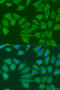 Alcohol Dehydrogenase 7 (Class IV), Mu Or Sigma Polypeptide antibody, 23-242, ProSci, Immunofluorescence image 