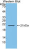 Protein Wnt-11 antibody, LS-C315041, Lifespan Biosciences, Western Blot image 