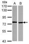 ENaCD antibody, LS-C155474, Lifespan Biosciences, Western Blot image 