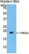 Coagulation Factor VIII antibody, MBS2002060, MyBioSource, Western Blot image 