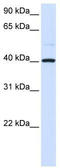 Glutamic-Oxaloacetic Transaminase 2 antibody, TA332130, Origene, Western Blot image 