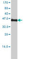 Potassium Voltage-Gated Channel Modifier Subfamily F Member 1 antibody, LS-C197572, Lifespan Biosciences, Western Blot image 