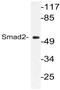 HsMAD2 antibody, AP21096PU-N, Origene, Western Blot image 