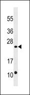 Dual specificity protein phosphatase 13 antibody, LS-C159495, Lifespan Biosciences, Western Blot image 