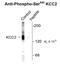 Solute Carrier Family 12 Member 5 antibody, OAPC00188, Aviva Systems Biology, Western Blot image 