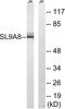 Sodium/hydrogen exchanger 8 antibody, GTX87292, GeneTex, Western Blot image 
