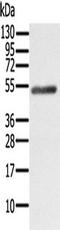Nuclear receptor ROR-beta antibody, TA351610, Origene, Western Blot image 