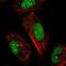 Arsenite Methyltransferase antibody, NBP1-85355, Novus Biologicals, Immunocytochemistry image 