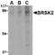 BR Serine/Threonine Kinase 2 antibody, MBS150129, MyBioSource, Western Blot image 