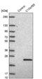 Chromosome 10 Open Reading Frame 55 antibody, NBP1-91710, Novus Biologicals, Western Blot image 