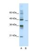 DEAD-Box Helicase 25 antibody, NBP1-57341, Novus Biologicals, Western Blot image 
