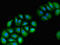 Vam6/Vps39-like protein antibody, LS-C680000, Lifespan Biosciences, Immunofluorescence image 