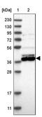 NET50 antibody, PA5-56649, Invitrogen Antibodies, Western Blot image 
