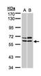 RB Binding Protein 8, Endonuclease antibody, orb315682, Biorbyt, Western Blot image 