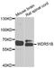POC1 Centriolar Protein B antibody, LS-C349271, Lifespan Biosciences, Western Blot image 