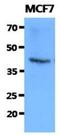 FKBP Prolyl Isomerase 10 antibody, NBP2-42645, Novus Biologicals, Western Blot image 