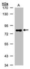 Tumor Protein P63 antibody, LS-C185484, Lifespan Biosciences, Western Blot image 