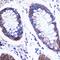 LSM4 antibody, GTX65884, GeneTex, Immunohistochemistry paraffin image 