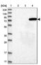 Acyloxyacyl Hydrolase antibody, NBP2-33892, Novus Biologicals, Western Blot image 