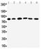 Proprotein Convertase Subtilisin/Kexin Type 1 antibody, PA2084, Boster Biological Technology, Western Blot image 