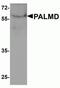 Palmdelphin antibody, NBP2-82018, Novus Biologicals, Western Blot image 