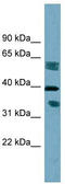 Dehydrogenase/Reductase 7B antibody, TA341981, Origene, Western Blot image 