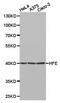 Homeostatic Iron Regulator antibody, PA5-37364, Invitrogen Antibodies, Western Blot image 