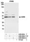 Cyclin Dependent Kinase 9 antibody, A303-492A, Bethyl Labs, Immunoprecipitation image 