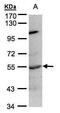 Protein Tyrosine Phosphatase Non-Receptor Type 1 antibody, PA5-28358, Invitrogen Antibodies, Western Blot image 
