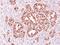 Arachidonate Lipoxygenase 3 antibody, LS-C185876, Lifespan Biosciences, Immunohistochemistry paraffin image 