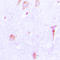 CTSE antibody, LS-C352068, Lifespan Biosciences, Immunohistochemistry frozen image 