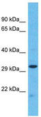 Protein Tyrosine Phosphatase Receptor Type M antibody, TA343316, Origene, Western Blot image 