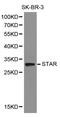 Guanylate Cyclase 2C antibody, orb129747, Biorbyt, Western Blot image 