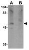 Phospholipid Phosphatase 4 antibody, GTX85224, GeneTex, Western Blot image 