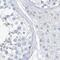 Chromosome 1 Open Reading Frame 87 antibody, NBP2-48611, Novus Biologicals, Immunohistochemistry paraffin image 