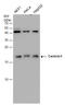 Calt antibody, GTX631353, GeneTex, Western Blot image 