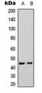 Mitogen-Activated Protein Kinase Kinase 1 antibody, LS-C368430, Lifespan Biosciences, Western Blot image 
