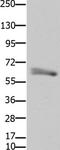 Forkhead Box P1 antibody, TA321920, Origene, Western Blot image 