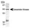 Ceramide Kinase antibody, TA301540, Origene, Western Blot image 