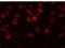 Regulator Of Microtubule Dynamics 2 antibody, GTX85107, GeneTex, Immunocytochemistry image 